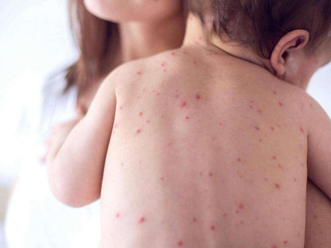 6220604a35a2a4ad382913bd5a4abfe6