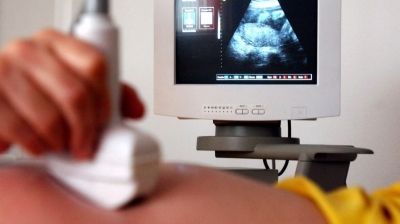 cead0d7e420c9ba579072dd964930376