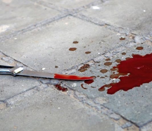 Молодой человек скончался в Махачкале в результате поножовщины