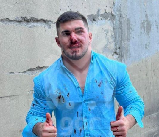 Чеченского блогера побили в Махачкале за неправильную парковку